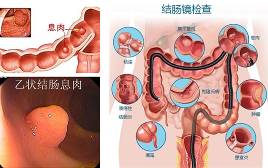 經(jīng)常放屁是在“排毒”？或許“根源”在腸道！