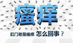 肛門瘙癢治不好嗎？先檢查病因就好辦！